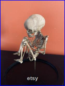 Réplique de squelette de foetus sous globe
