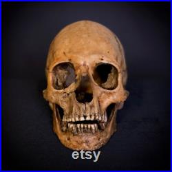 Réplique du crâne humain (mâle, allongé, déformation intravitale), plastique. La première copie de l original.