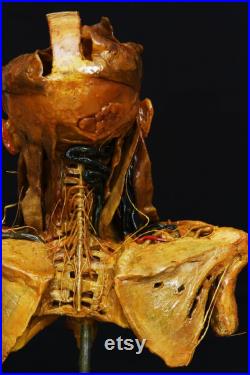 modèle anatomique buste écorché cabinet de curiosité en cire taxidermy wax anatomical modèle anatomique buste écorché cabinet de curiosité en cire taxidermy wax anatomical